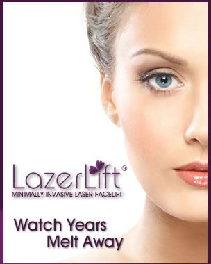 Laser Lift The Villages Florida Laser Facelift